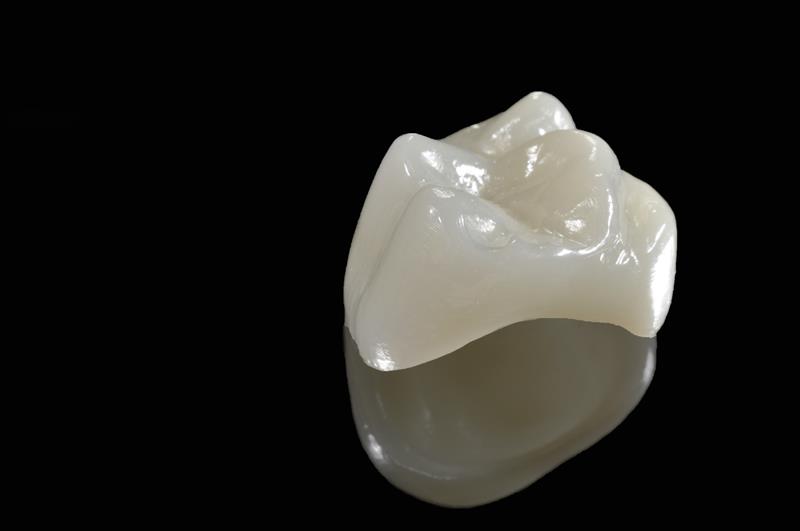 Porcelain Crowns  Hamilton HM